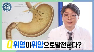 자칫하면 위암으로 발전할 수 있는 명치 통증, ‘위염’의 세심한 관리법은?｜경상국립대학교병원 소화기내과 이창민교수 [#건강좋은날플러스 ep.16]｜MBC경남 220302 방송