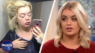 10 Shocking Plastic Surgery Horror Stories