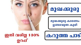 മുഖക്കുരു വന്നാലും കറുത്തപാട് വരാതെ facebeauty tips l 1sec മതി എന്നും നമ്മൾ use ചെയ്യുന്ന സാധനംമതി