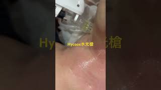 來自韓國的水光槍（HYCOOX海庫斯智能水光儀），是一種電動玻尿酸注射幫浦。儀器配有無菌多針座穿刺針和注射器，用於將玻尿酸注射至臉部皮膚中 #skincare #永茂醫美永遠為妳 #東區達哥