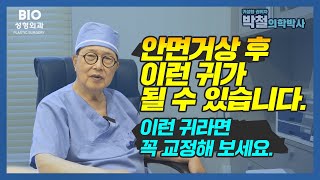 안면거상 후 이런 귀가 될 수 있습니다. 이런 귀모양이면 꼭 교정해 보세요.