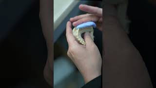 Diagnostic Wax Up Putty