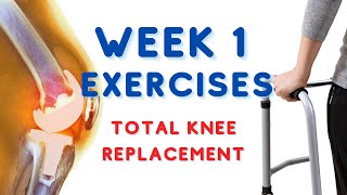 Week 1 Exercises: Total Knee Replacement