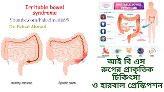 আই,বি, এস রুগ নিরাময়ে প্রাকৃতিক চিকিৎসা || Natural Remedies for IBS