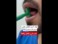 التدريب على حرف ر علاج_النطق علي_ابوورده