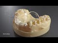 stratasys j5 dentajet dental 3d printer