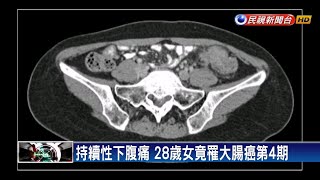 持續性下腹痛 28歲女竟罹第4期轉移大腸癌－民視新聞