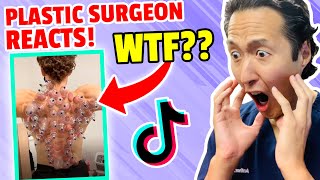 Plastic Surgeon Reacts to INSANE TikTok Videos!