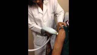 Emvera Diolux Laser Hair Removal