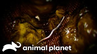 A Young Teenager Vomiting Fecal Matter | Monsters Inside Me | Animal Planet