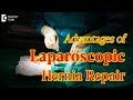 What are the advantages of laparoscopic hernia repair? - Dr. Nanda Rajaneesh