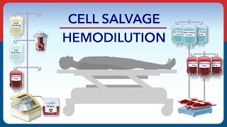 Cell Salvage and Hemodilution