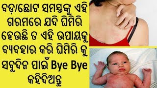 ବଡ଼/ଛୋଟ ସମସ୍ତଙ୍କୁ  ଗରମରେ ଯଦି ଘିମିରି ହେଉଛି ତ ଏହି ଉପାୟ କୁ ବ୍ୟବହାର କରି ଘିମିରି କୁ ସବୁଦିନ ପାଇଁ ଦୂର କରନ୍ତୁ