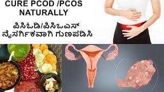 PCOD problem solution in kannada|PCOD Diet Plan in Kannada|Simple tips for PCOD|My PCOD story|PCOS
