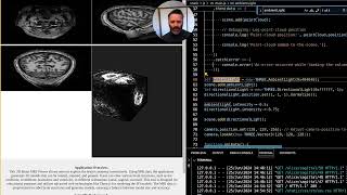 Enhancing 3D Brain MRI Visualization: Implementing Real-Time Rendering with Optimized Techniques