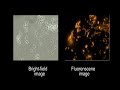 Bacterial Imaging