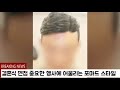 광주가발 쓰리업가발 강도테스트