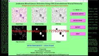Python Code Leukemia Blood Cancer Classification Using CNN | Python Source Code | Final Year Project