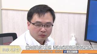 瘜肉病變成大腸癌 透過內視鏡完整切除癌細胞