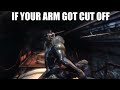 If your arm got cut off, would it hurt?