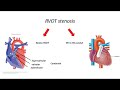 Post Cath Conference, TPVI workshop (Venous P-valve)  24 May 2023