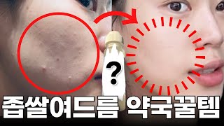 좁쌀여드름 약국 꿀템 이 영상으로 종결지을게요ㅣ제대로 된 사용방법, 주의사항