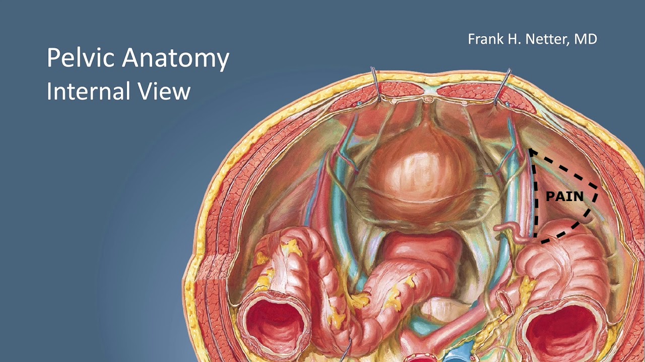 Preperitoneal Inguinal Hernia Surgery - Dr David Lourié - YouTube