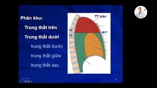 TRUNG THẤT | Ôn thi SĐH | TS. BS. Nguyễn Hoàng Vũ