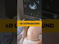 ❤️❤️4d ultrasound during pregnancy |  Pravi hospital