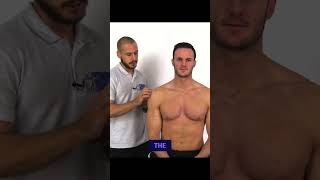 The Arm Squeeze Test for Cervical Nerve Root Compression