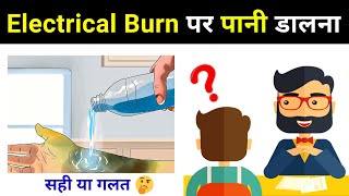 Can we put water on Electric Burn? इसका जवाब सभी गलत देते हैं।
