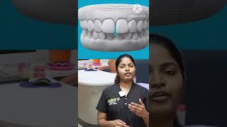 முன் பல் இடைவெளி 2 வகை படும். இதில் நீங்கள் எந்த வகை?🧐😮#shorts #dentist #toothgap