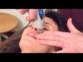 CRAZY SINUS RELEASE: Chiropractic Adjustment