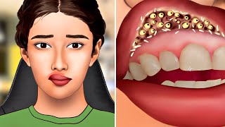 ASMR Remove botfly maggots found inside mountaineer's mouth | Dental care animation | Beauty ASMR