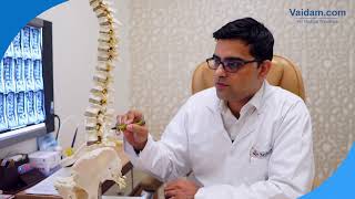 Spine Fixation - Best Explained by Dr. Manish Raj of Yatharth Hospital, Noida