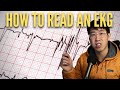 How To Read An EKG In 2023 (High Yield)