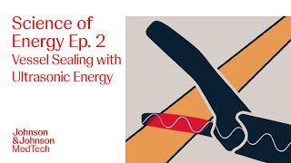 How Ultrasonic Energy Impacts Tissue | Science of Energy Ep. 2 | J&J MedTech