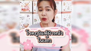 โรคภูมิแพ้ผิวหนังในเด็ก