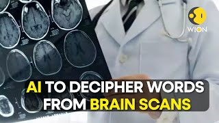 Scientists can now use AI to convert brain scans into words