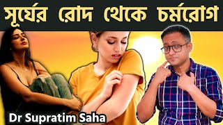 সূর্যের রোদ থেকে ত্বকের রোগ | কিভাবে সারাবেন ? PMLE | Treatment | Bengali | Dr Supratim Saha