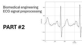 Biomedical Engineering - ECG signal Preprocessing in Python (PART#2 - R peaks detection)