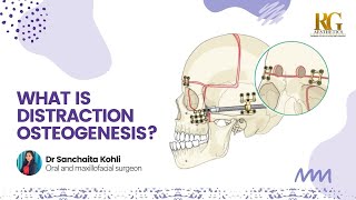 What is Distraction Osteogenesis? Reconstructing your jaw profile | Dr. Sanchaita Kohli | Delhi