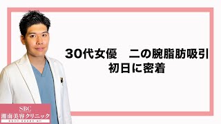 【女優の二の腕脂肪吸引】施術当日に密着！