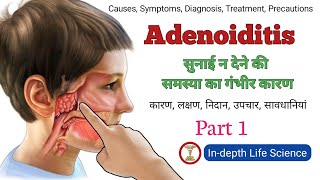 हियरिंग लॉस का एक बड़ा कारण - ऐडेनोइड्स | adenoiditis | hearing loss | ear infection