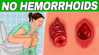 How to get rid of hemorrhoids fast! Know the causes, signs, symptoms and treatment of hemorrhoids