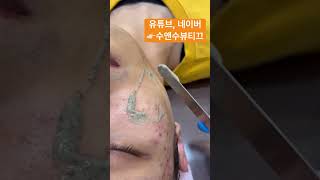 효과좋은 #흉터케어 하지만! 하나도 안아파요 #안아픈필링