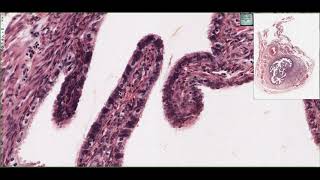 Histology of the Oviduct (Fallopian Tubes) 4K