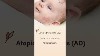 Baby Skincare Products to Tackle Issues Such as Atopic Dermatitis