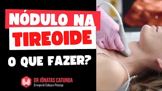 Tratamento do nódulo na tireoide benigno e maligno