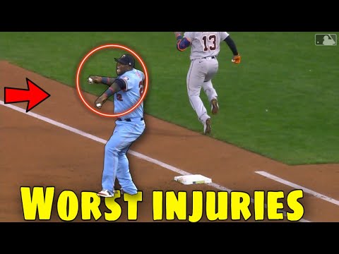 MLB | Worst Baseball Injuries - YouTube